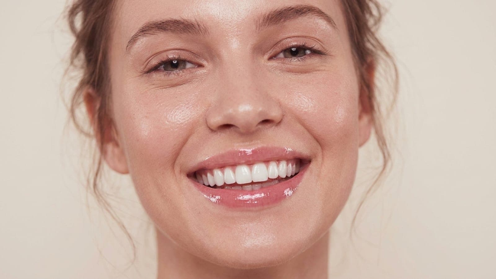 Lente de contato dental: vale a pena? Tire suas dúvidas